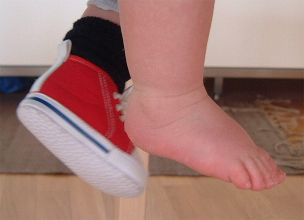 Una strada in salita da percorrere insieme creativamente: la diagnosi di disabilità alla nascita